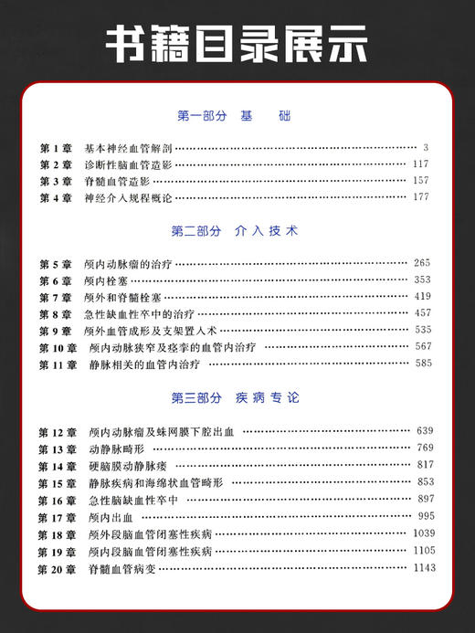 脑血管病和神经介入技术手册 第3版 王君 梁永平 主译 儿科神经介入学儿童神经内科学解剖外科血管心脏病学造影治疗颅内动脉瘤栓塞 商品图2