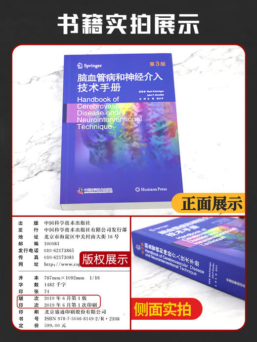 脑血管病和神经介入技术手册 第3版 王君 梁永平 主译 儿科神经介入学儿童神经内科学解剖外科血管心脏病学造影治疗颅内动脉瘤栓塞 商品图1