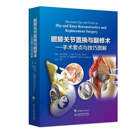 髋膝关节置换与翻修术——手术要点与技巧图解