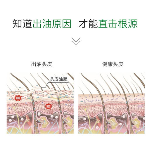 薇姿抗头皮屑洗发露200ml 商品图5