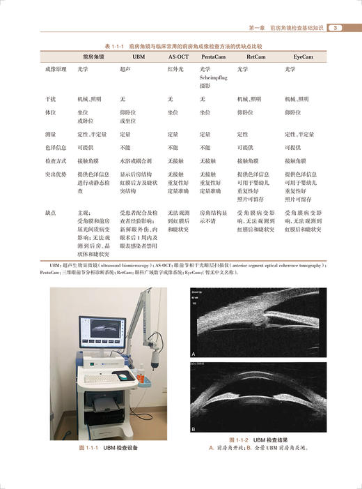 前房角镜检查图谱 乔春艳 眼科基本检查 疾病特征 青光眼激光手术治疗应用 眼科医生必备参考工具书 人民卫生出版社9787117346542 商品图3