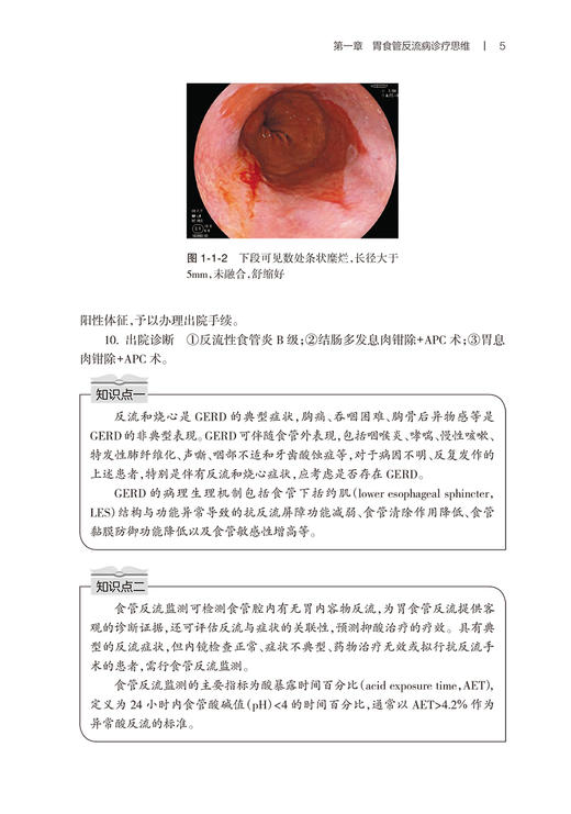 消化系统常见疾病诊疗思维 董卫国 于红刚主编 消化道肝胆胰常见疾病临床诊疗流程 典型病例诊治思路 人民卫生出版社9787117346504 商品图4