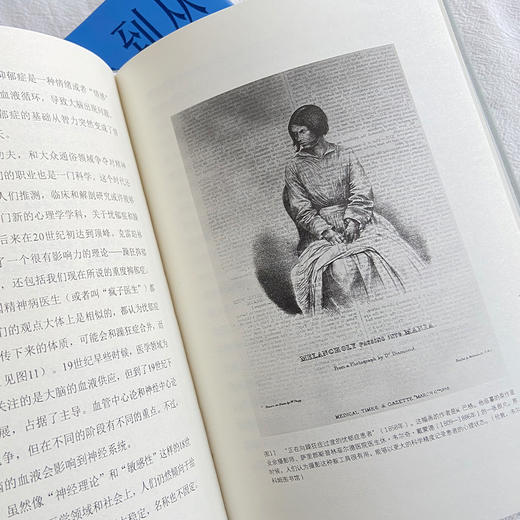 抑郁症的历史（从忧郁症到抑郁症。2500年来，人类如何认识抑郁症） 商品图6