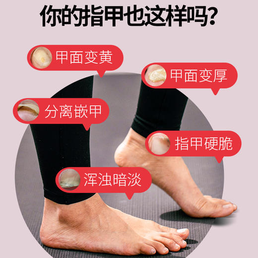 【养甲辅助 保卫手足】日本汉方灰甲护理液  滋养不损甲根  灰指甲液30ml/瓶 商品图1