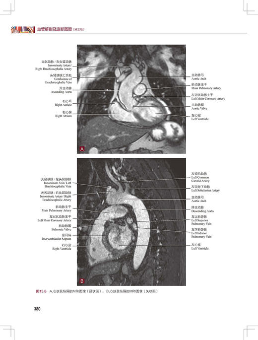 血管解剖及造影图谱 第3版 陶晓峰 董伟华 主译 血管介入治疗解剖学基础 临床操作陷阱 DSA造影 北京科学技术出版社9787571426507 商品图2