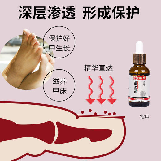 【养甲辅助 保卫手足】日本汉方灰甲护理液  滋养不损甲根  灰指甲液30ml/瓶 商品图3