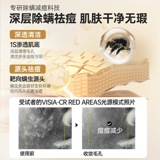 儒意男士安肤洁面乳300g 氨基酸洗面奶 除螨祛痘美白 深层清洁毛孔 控油男士专用洁面乳  | 儒意官方商城 商品图4