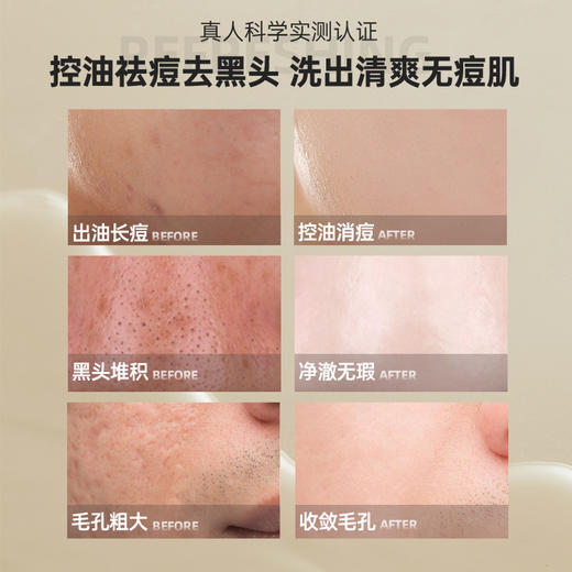 儒意男士安肤洁面乳300g 氨基酸洗面奶 除螨祛痘美白 深层清洁毛孔 控油男士专用洁面乳  | 儒意官方商城 商品图3