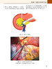 胃癌规范化手术 季加孚 步召德 配视频 胃癌开腹手术操作步骤 实际解剖术中照片 肿瘤外科治疗 北京大学医学出版社9787565927928 商品缩略图4