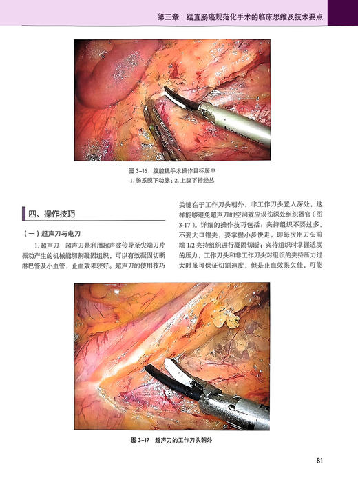 结直肠癌规范化手术 季加孚 步召德 配视频 结直肠临床应用解剖 常用术式规范操作方法 外科手术 北京大学医学出版社9787565927690 商品图4