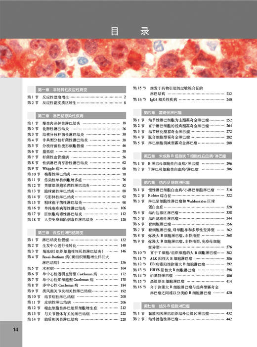 淋巴结及结外淋巴瘤病理诊断学 第2版 高子芬 刘翠苓 译 临床病理特征诊断要点 血液病理医生案头手册9787117343596人民卫生出版社 商品图2