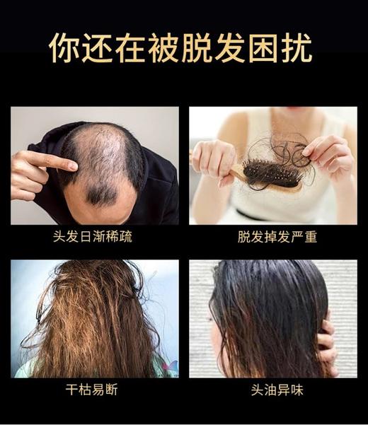 同仁堂防脱固发洗发露（黑瓶） 商品图3