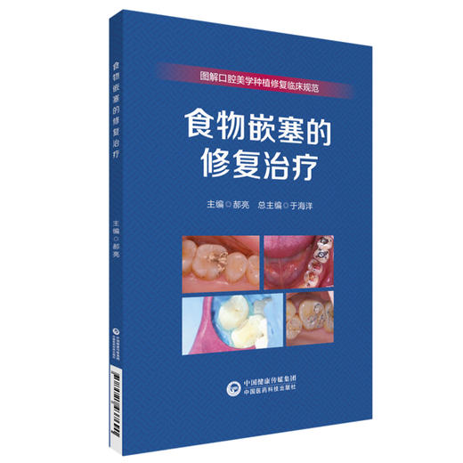 食物嵌塞的修复治疗 郝亮 编 图解口腔美学种植修复临床规范 牙齿食物嵌塞牙体修复治疗技术要点 中国医药科技出版社9787521437690 商品图0