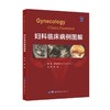 妇科临床病例图解 商品缩略图0