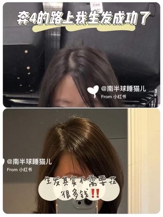 秃发星人的救星！拯救发际线！GROW GORGEOUS 生发固发精华90ml限时bug价！ 商品图2