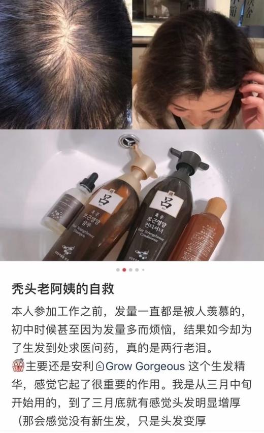 秃发星人的救星！拯救发际线！GROW GORGEOUS 生发固发精华90ml限时bug价！ 商品图4