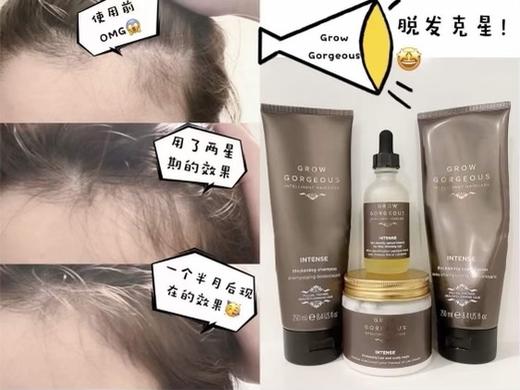 秃发星人的救星！拯救发际线！GROW GORGEOUS 生发固发精华90ml限时bug价！ 商品图3