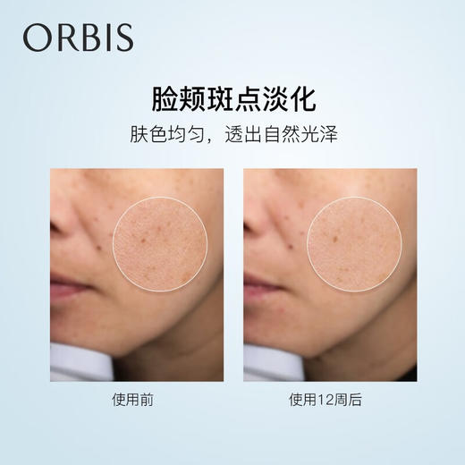ORBIS奥蜜思锐真美白精华液 25ml 祛斑碎黑 强韧肌肤 白里透光 商品图3