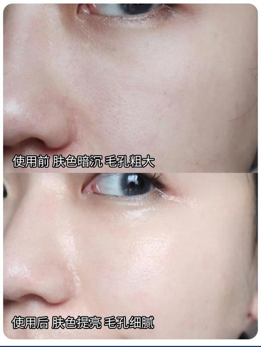 【清仓好价】Gniega玻尿酸面膜25g*5片盒装 2盒/6盒 商品图2