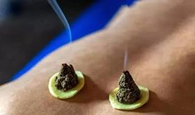  艾灸是否有效的“金标准”——灸透！看看你灸透了没？ 