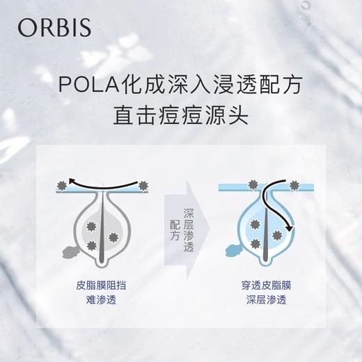 ORBIS奥蜜思河汉净痘肌原水(清爽型) 180ml 祛痘控油爽肤水 商品图1