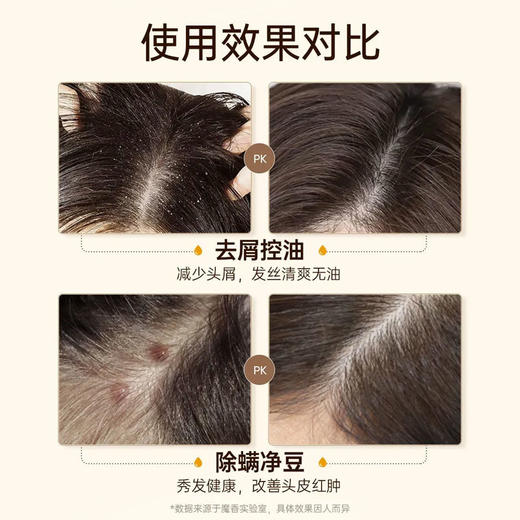 硫磺洗发水去屑止痒控油去油蓬松持久留香洗发液男女生洗发露 商品图8