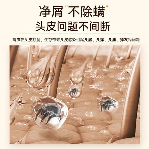 硫磺洗发水去屑止痒控油去油蓬松持久留香洗发液男女生洗发露 商品图9