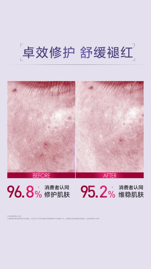 【全球购】【89元会员福利】欧莱雅复颜玻尿酸水光充盈导入安瓶鲜注玻色因面膜33g*5片 商品图3