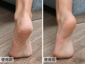 汗脚严重、臭味熏人？那就试试这个小东西，每天一喷，清除异味，还你健康双脚~