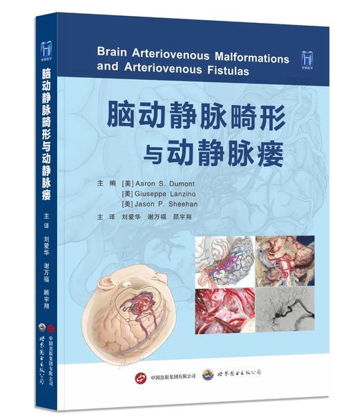 现货 “ 传世 ” 新作丨《脑动静脉畸形与动静脉瘘》中译本正式出版，Aaron 教授等主编，刘爱华、谢万福、顾宇翔教授主译 商品图1