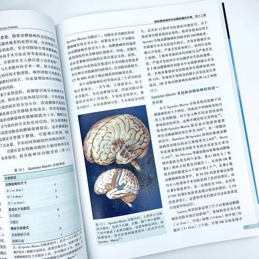 现货 “ 传世 ” 新作丨《脑动静脉畸形与动静脉瘘》中译本正式出版，Aaron 教授等主编，刘爱华、谢万福、顾宇翔教授主译 商品图3