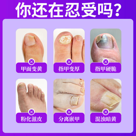 【应季好物】日本汉方灰指甲护理液30ml 商品图2