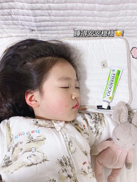 法国Boiron宝宏止痒膏 蚊虫叮咬止痒消包舒缓修复30g 商品图7