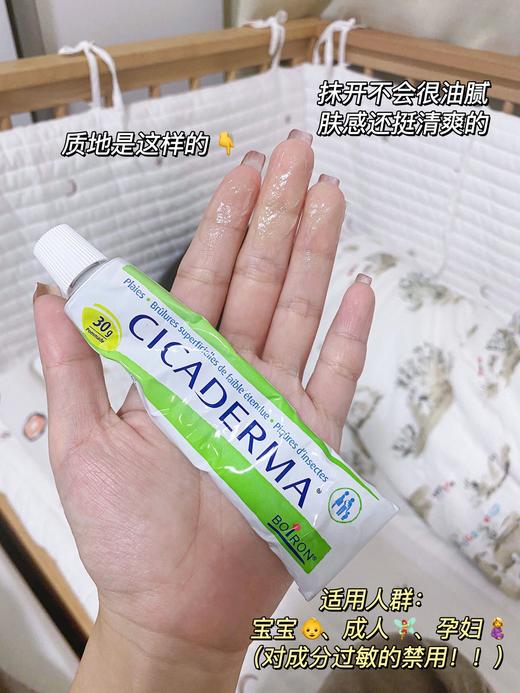 法国Boiron宝宏止痒膏 蚊虫叮咬止痒消包舒缓修复30g 商品图4