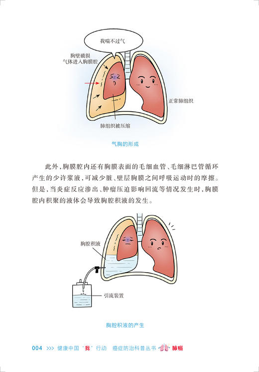 肺癌 健康中国我行动 癌症防治科普丛书 支修益 张兰军 肺癌防治科普知识 预防诊断筛查治疗康复训练 人民卫生出版社9787117341936 商品图3