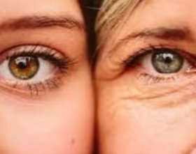  你知道吗！艾灸可以去除皱纹！ 