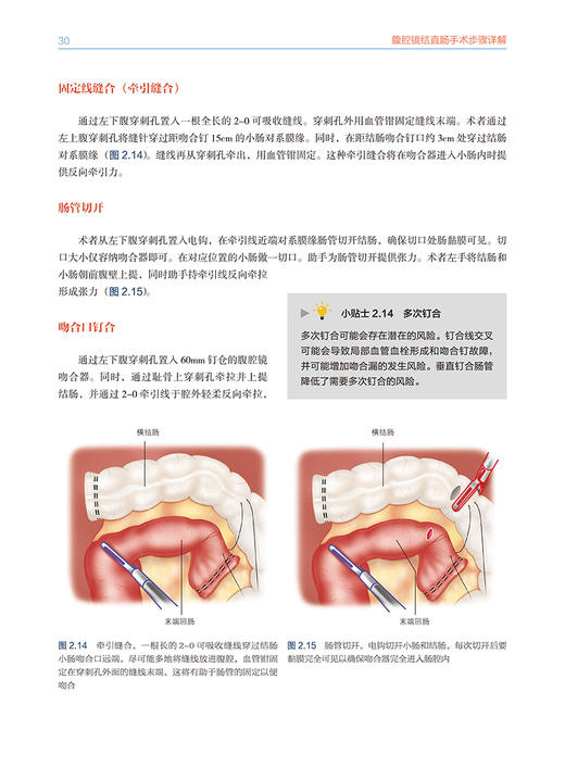 腹腔镜结直肠手术步骤详解 钟鸣 等译 外科手术适应症操作注意事项 肠粘连松解等并发症预防鉴别 辽宁科学技术出版社9787559129536 商品图3
