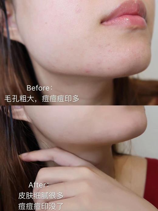 【清仓好价】法国Garancia格蕾森亚无酸精华 5ml /5ml*3 商品图1