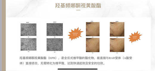 【可私申请尝鲜 猪猪夜用新宠】10克双A A醇精华乳尝鲜装 晚上VA醇白天VC   精华 双重A醇添加 淡黄乳液质地又薄又细又润 专利纳米脂质体包裹 商品图7