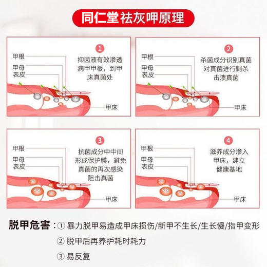 【不伤好甲 远离灰甲】南京同仁堂绿金家园灰甲液 养甲护甲滋养甲根 专攻灰甲远离灰甲灰指甲 灰甲液30ml/瓶 商品图2