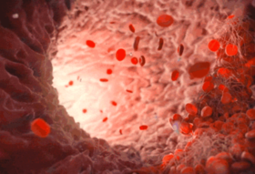  红酒、陈醋、木耳真的能软化血管吗？ 