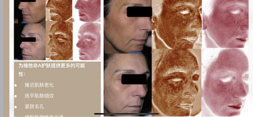 【可私申请尝鲜 猪猪夜用新宠】10克双A A醇精华乳尝鲜装 晚上VA醇白天VC   精华 双重A醇添加 淡黄乳液质地又薄又细又润 专利纳米脂质体包裹 商品图8