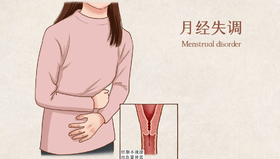 停经、闭经怎么忽然出现？5大提前停闭经信号一定要警惕！