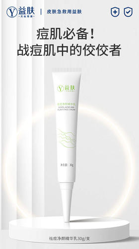 痘肌必备！战痘肌中的佼佼者