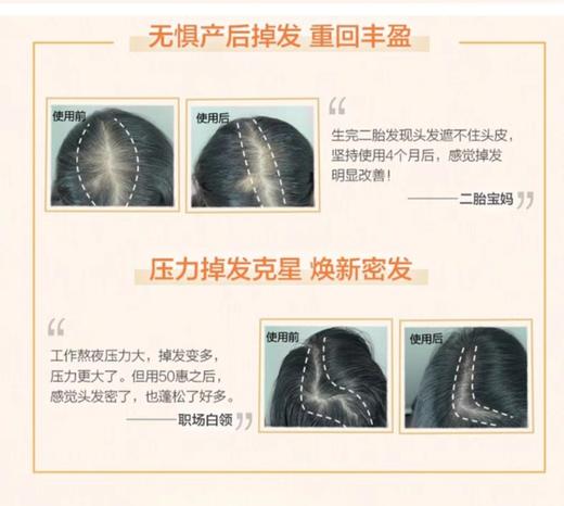 日本 50惠乐敦养润丰盈洗发露/护发素-400ML 商品图5