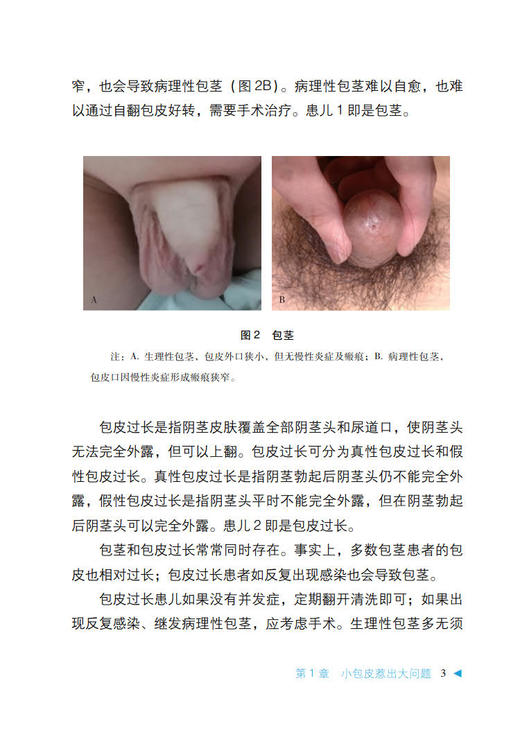 男性健康从娃娃抓起18岁前的男言之隐 谢起根 邓春华 中华医学会男科分会男性健康系列科普 中华医学电子音像出版社9787830053666 商品图4