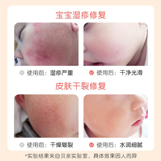 贝亲新生儿早产儿修复皮肤屏障婴儿护理油抚触油出院护肤推荐 商品图7