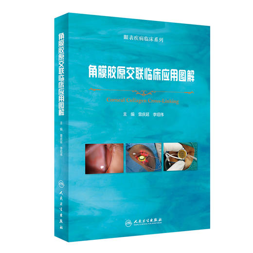 角膜胶原交联临床应用图解 曾庆延 李绍伟 眼表疾病临床系列 角膜扩张性疾病诊断 CXL治疗技术操作 人民卫生出版社9787117346566 商品图1