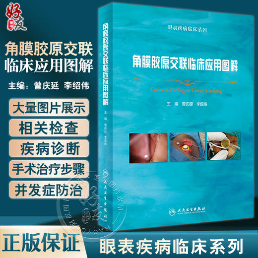 角膜胶原交联临床应用图解 曾庆延 李绍伟 眼表疾病临床系列 角膜扩张性疾病诊断 CXL治疗技术操作 人民卫生出版社9787117346566 商品图0