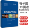 青光眼OCT图谱 戴毅主译 商品缩略图0